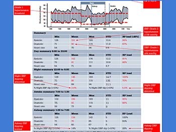 Blood Pressure Variability: The Good And The Bad