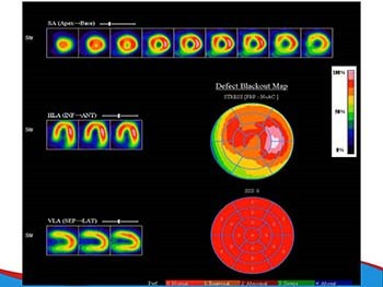 Cardiovascular imaging