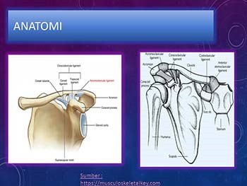 Distal Clavicle Fracture