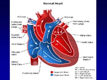 Tetralogy of Fallot