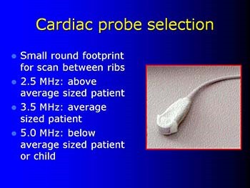 Cardiac Ultrasound in Emergency Medicine