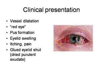 Eye Ear Nose and Throat Infections