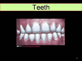 Dental Emergencies and Common Dental Blocks