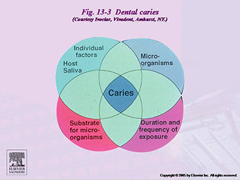 Dental Caries