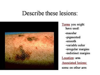 Aging Dermatology and Disease