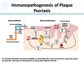 Applying Science to Improve the Individualized Treatment of Patients with Psoriasis