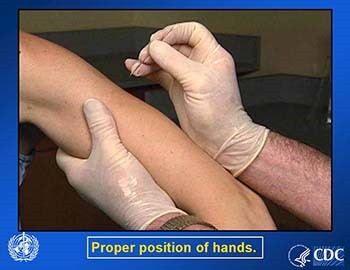 Smallpox Vaccine Overview