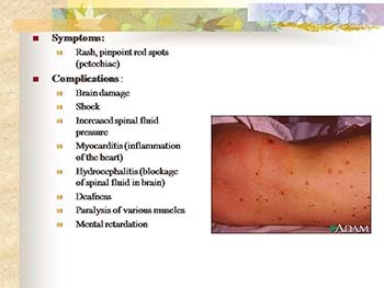 Diseases of the Nervous System