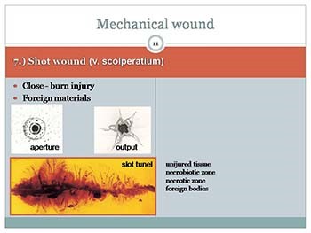 Classification and management of wound principle of bleeding control
