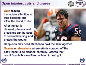 Common Adolescent and Young Adult - Sports Injuries