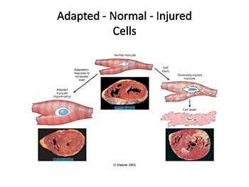 Cell Injury Death Inflammation and Repair