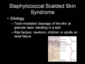 Dermatologic Emergencies