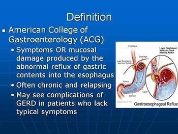 Gastroesophageal Reflux Disease