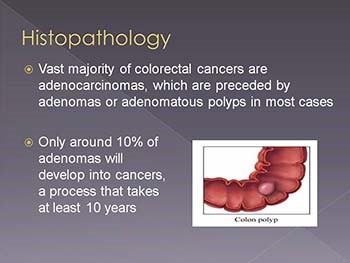 Epidemiology of Colorectal Cancer
