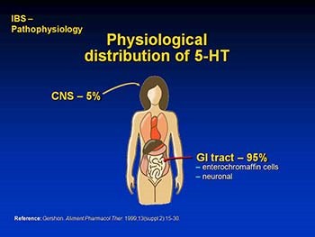 IRRITABLE BOWEL SYNDROME