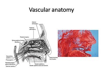 Radiology of Nasal Cavity and Paranasal Sinuses