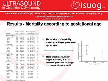 Perinatal mortality timing of delivery and prenatal management of monoamniotic twin pregnancy