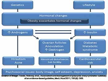 Polycystic Ovary Syndrome