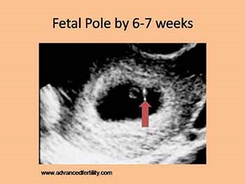 Issues in Early Pregnancy