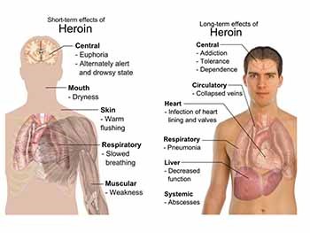 OPIOID ANALGESICS