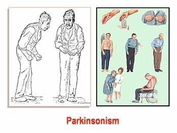 Antiparkinsonian drugs