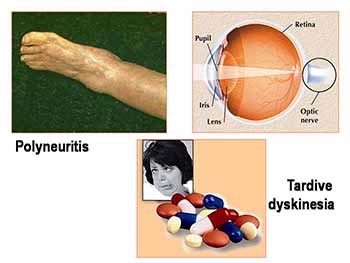 Adverse Drug Reactions