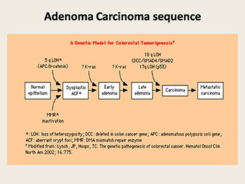 Benign And Malignant Tumors of The Rectum