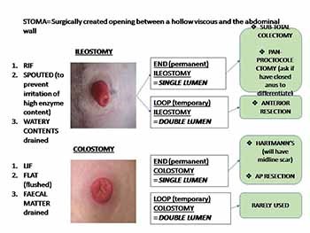 Colorectal - The Surgical Formula