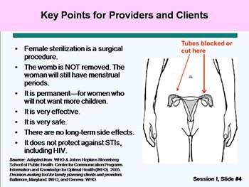 Characteristics of Tubal Ligation