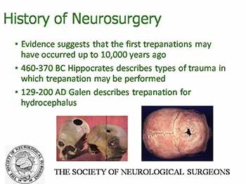 Introduction to Neurosurgery