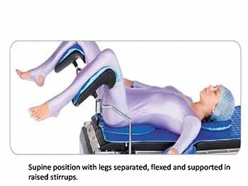 Patient Positioning