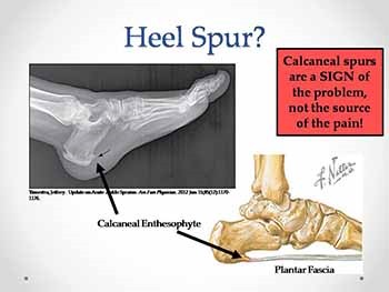 Foot and Ankle Injuries
