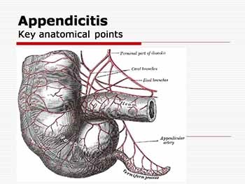 Appendicitis in children