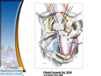 Robotic Surgery in Reconstructive Urology