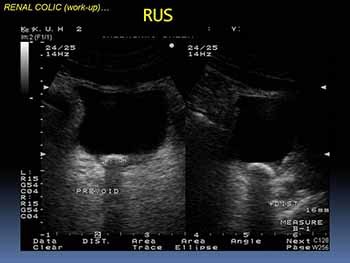 Emergency in Urology