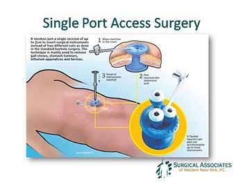 Whats New & Cool in Surgery