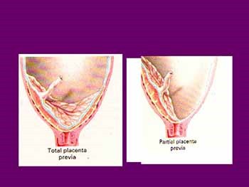 OB and GYN EMERGENCIES