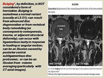 Radiological imaging of degenerative and inflammatory disease of the spine