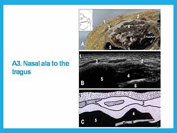 ULTRASOUND IMAGING