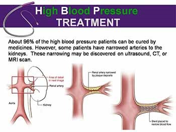 Vascular and Interventional Radiology