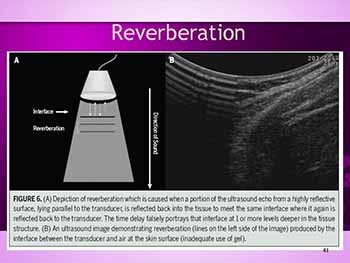 Rehabilitative Ultrasound Imaging-a Musculoskeletal Perspective
