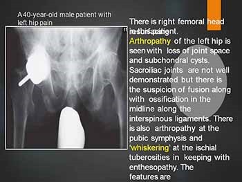 Musculoskeletal imaging Rapid review of radiology
