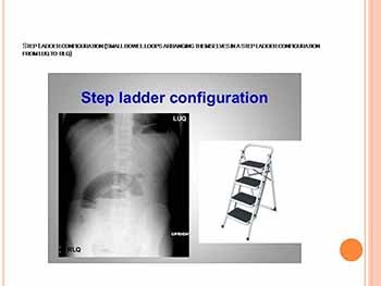 IMAGING IN INFLAMMATORY BOWEL DISEASE