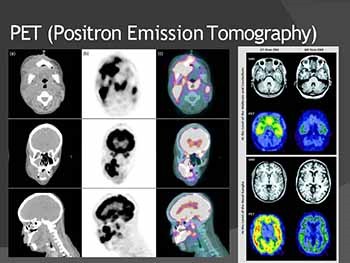 Medical Imaging