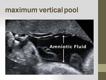 Radiology and Imaging in OB-GYN