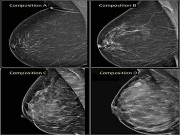 IMAGING BREAST CANCER