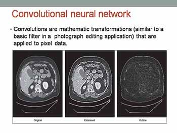 ARTIFICIAL INTELLIGENCE AND RADIOLOGY