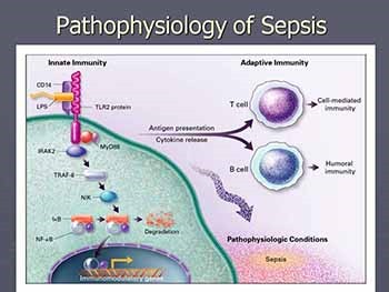 Sepsis-Pathophysiology and Treatment