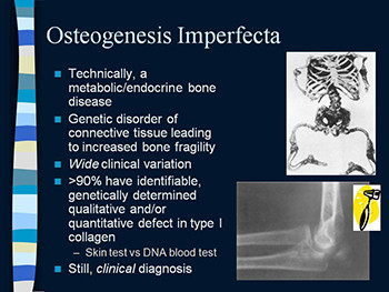 Syndromes of Orthopaedic Importance