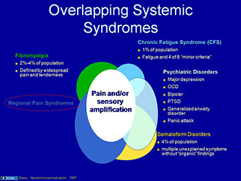 Evaluating diffuse aches and pains